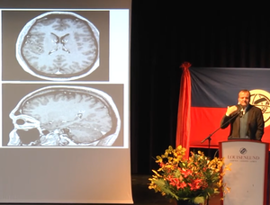 Spitzer-Digitalisierung-Gehirn-Kinder_300 image Digitale Demenz - Vortrag von Manfred Spitzer